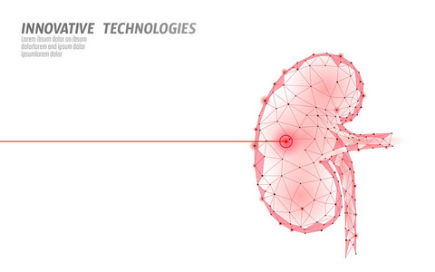人肾激光手术低聚。药物疾病治疗疼痛部位。红色三角形多边形3d 渲染形状。药房石头癌症恢复模板向量例证