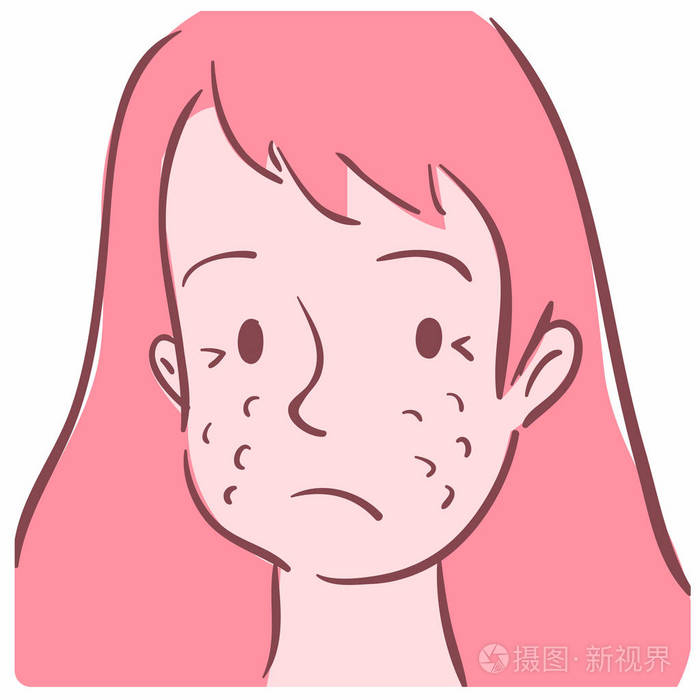 有痤疮的女孩脸的插图. 可作为皮肤科的象征