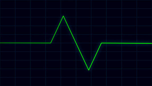 绿色心跳脉冲心电图屏幕Ekg心脏保健概念
