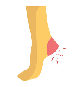 脚跟疼痛平面图标设计