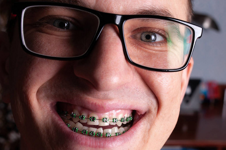 一位戴着金属牙套和眼镜的年轻人的脸。