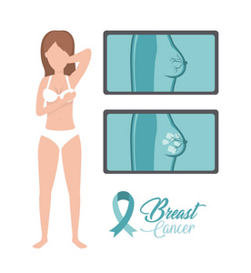 女性乳腺癌诊断预防矢量图