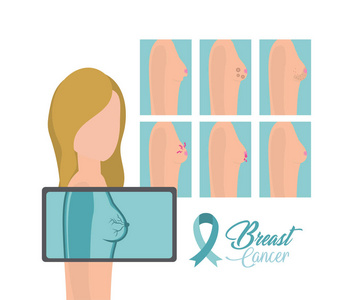 女性乳腺癌预防诊断向量说明