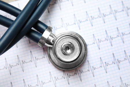 医用听诊器在纸上，心电图顶部视图。 心脏学概念