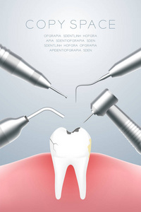 牙科器械用蛀牙和牙胶插图3D虚拟设计隔离在灰色梯度背景与复制空间矢量EPS10