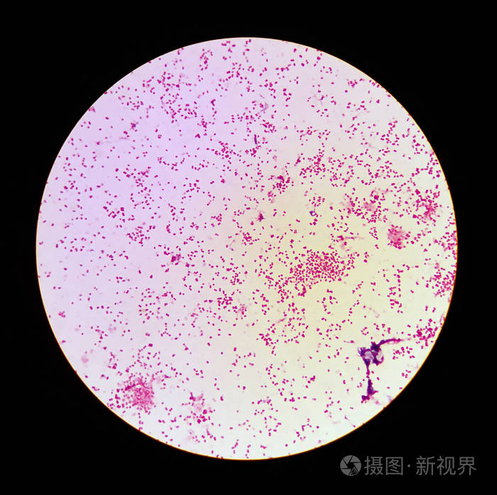 淋病的显微观察(淋病奈瑟菌)