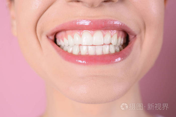 年轻女子健康的牙齿和美丽的微笑,彩色背景特写照片-q