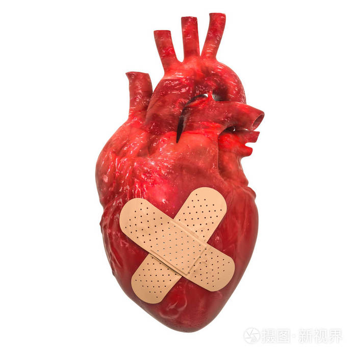 人的心用粘合石膏 治疗心脏病概念3d渲染分离在白色背景上