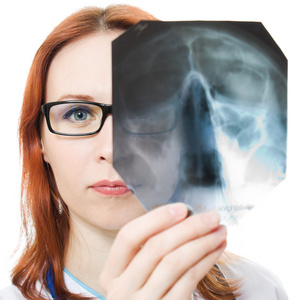 女医生检查在白色背景上的 x 射线图像