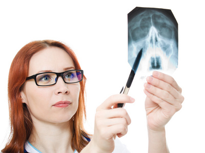 女医生检查在白色背景上的 x 射线图像