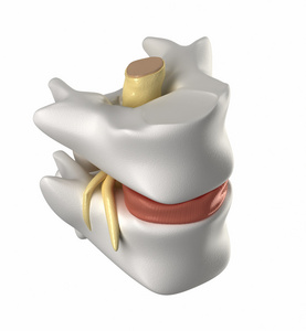 颈椎 腰间盘突出症和脊髓损伤