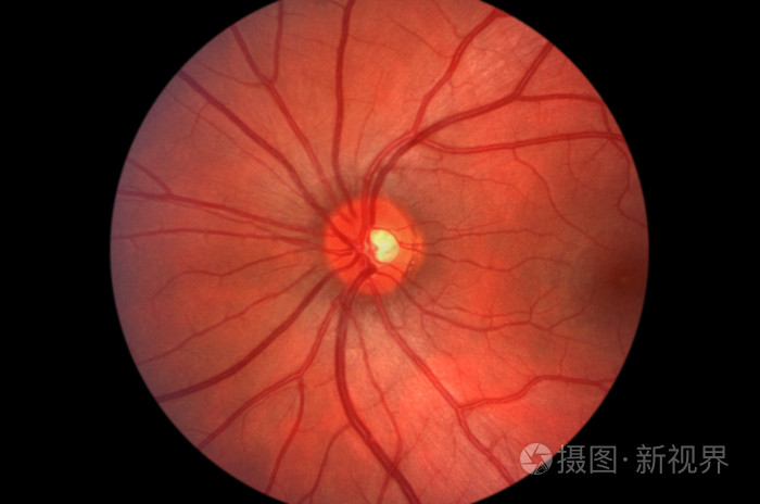 人类视网膜视神经