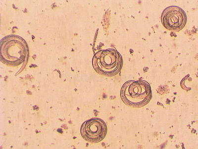 旋毛虫寄生虫显微镜