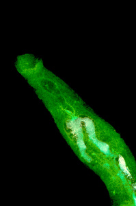 动物 parasiteras 血吸虫血吸虫