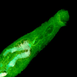 动物 parasiteras 血吸虫血吸虫