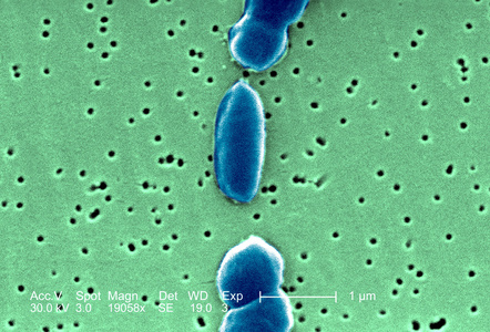 在显微镜下的细菌图片