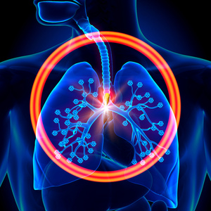 肺部异物吸入或吞下