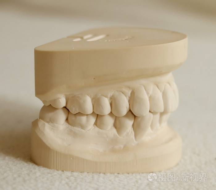 牙科石膏模型模具的牙齿