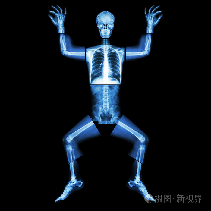 jigsaw human x-ray ( whole body : head skull face neck spine sho