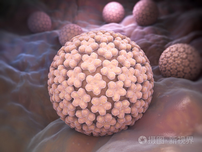 人乳头瘤病毒照片-正版商用图片1iw8a0-摄图新视界