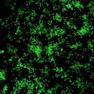 表达绿色荧光蛋白的乳腺癌细胞影像学研究