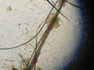 猫受损皮肤科的头发小孢子虫, 显微镜