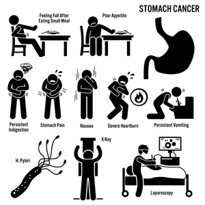 胃肿瘤症状原因风险因素诊断棒图象形图图标