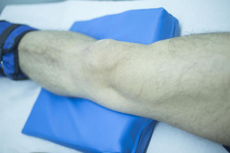踝关节 努力 医疗保健 肌肉 诊所 运动 成人 疼痛 弯曲