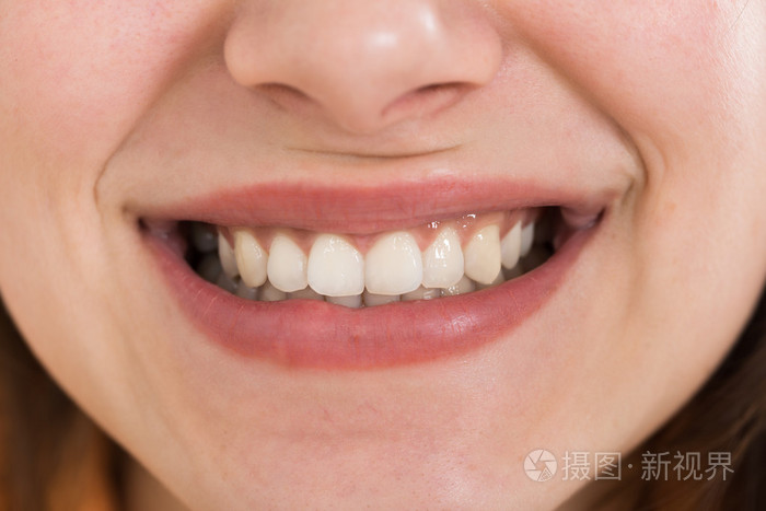 女性与健康洁白的牙齿微笑