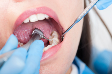 为病人牙齿使用牙钻
