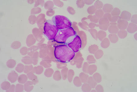 健康 医学 抗原 生物学 人类 颗粒状 嗜碱性粒细胞