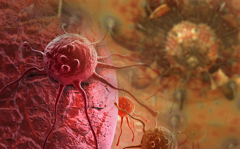 3d 渲染的癌症细胞在人体内