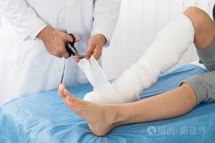 医生病人包扎的腿