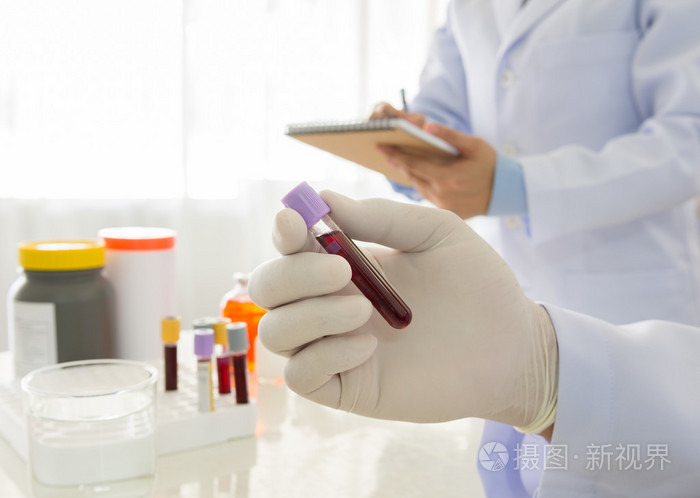 抽血化验医生拿着一瓶血