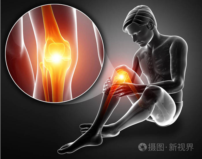 3d插图的男性感觉膝关节疼痛