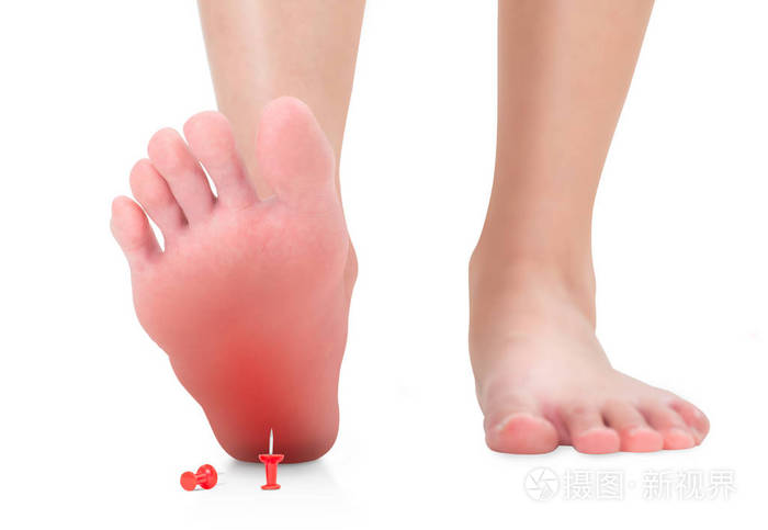 女性脚踩在红色图钉上的前视图意料之外的概念红色高光隔离在白色背景
