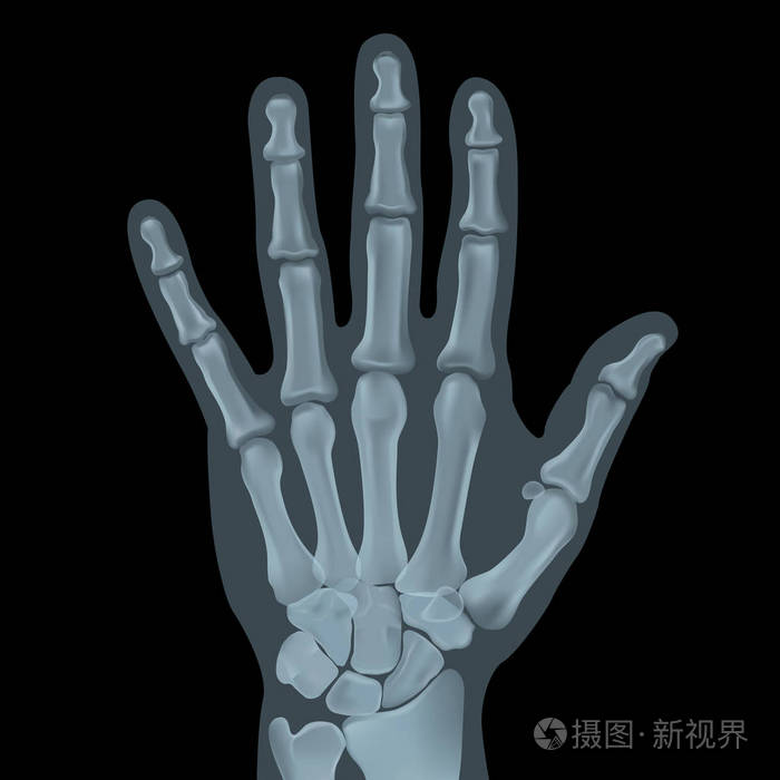 真实的人手掌x光拍摄