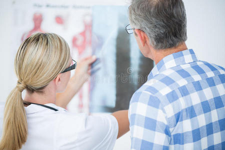 医生给她的病人看X射线