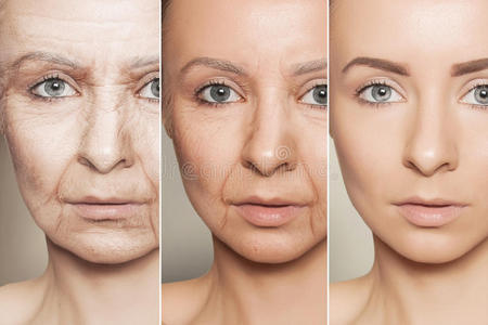 白种女人脸上的抗衰老程序