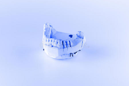 人工牙的石膏模型
