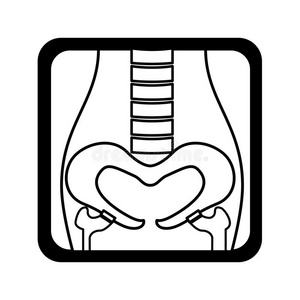 骨架 放射学 签名 健康 医院 胸部 解剖 人类 照顾 插图