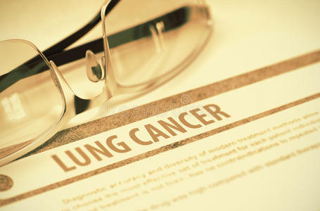 诊断肺癌。 医学概念。 三维插图。
