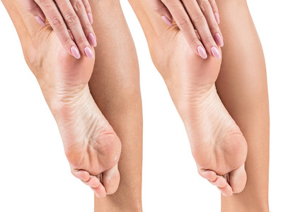 治疗前后皮肤干燥的足部。
