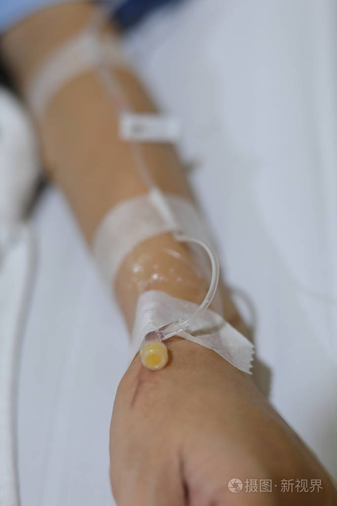 卧床病人静脉输液静脉注射