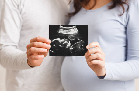 孕妇和她的丈夫给孩子做超声波扫描