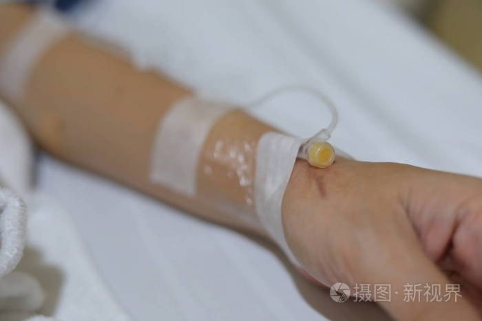 卧床病人静脉输液静脉注射