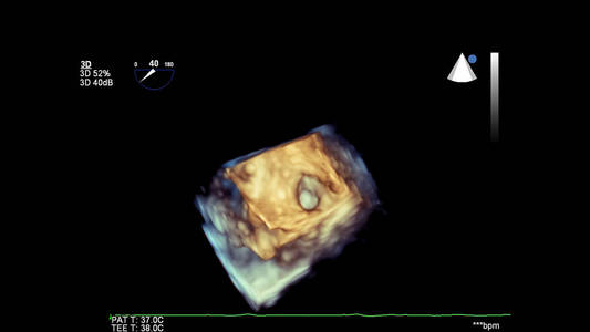 胚胎 工具 流产 机器 医学 集中 轮廓 子宫 生活 放射科医生