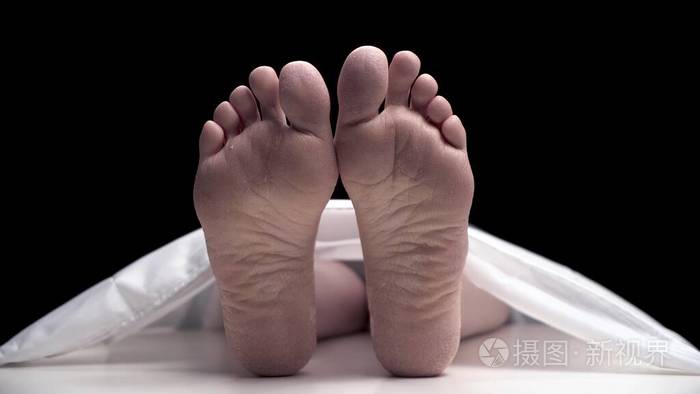 停尸房里的裸体躺在桌子上的一张白色床单下手指在