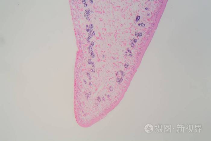 普通肝吸虫吸虫的显微镜下切片