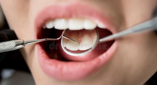 宏指令射手关于年幼的女人所有牙齿的检查在上面采用牙齿的cl采用i